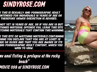 Advanced anal fisting & prolapse at one's fingertips get under one's rocky coast Sindy Scallop